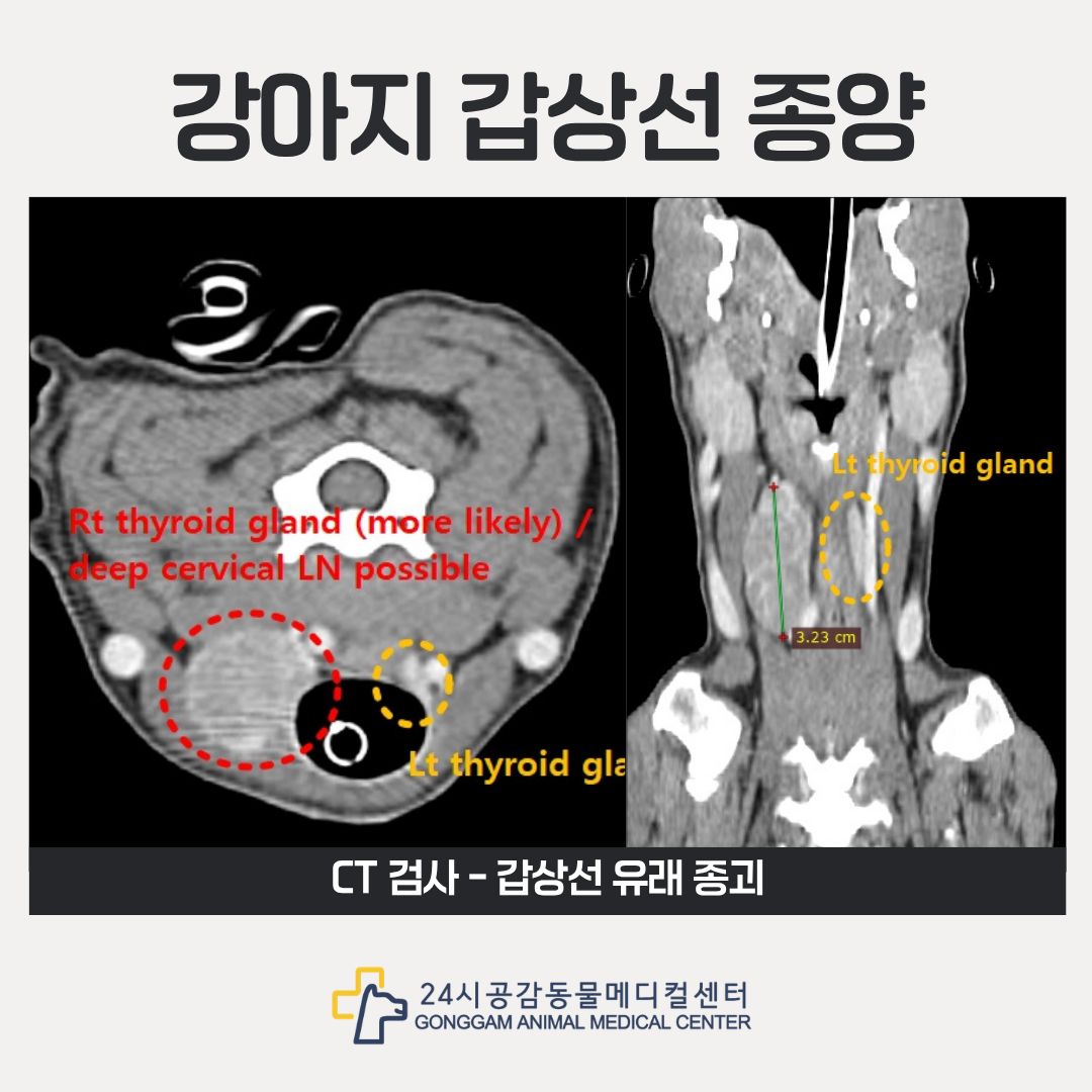 갑상선 종괴 CT검사