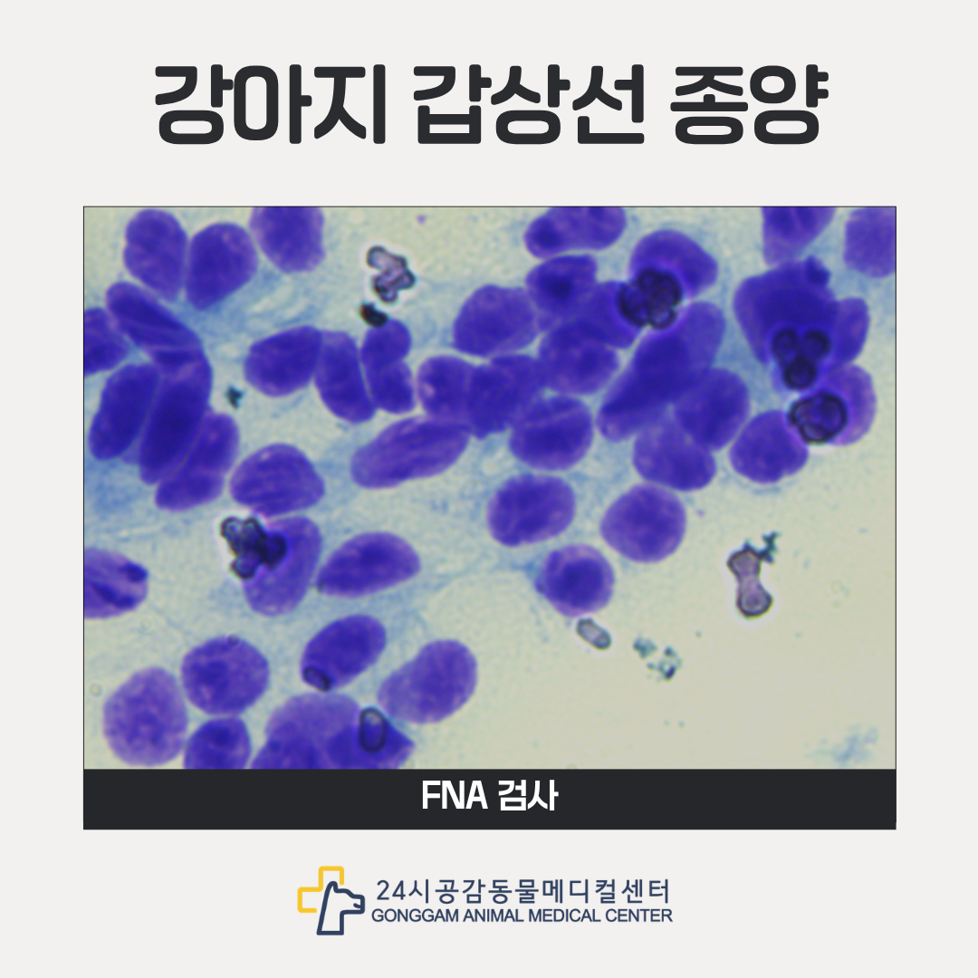 갑상선 종괴 세침흡인검사