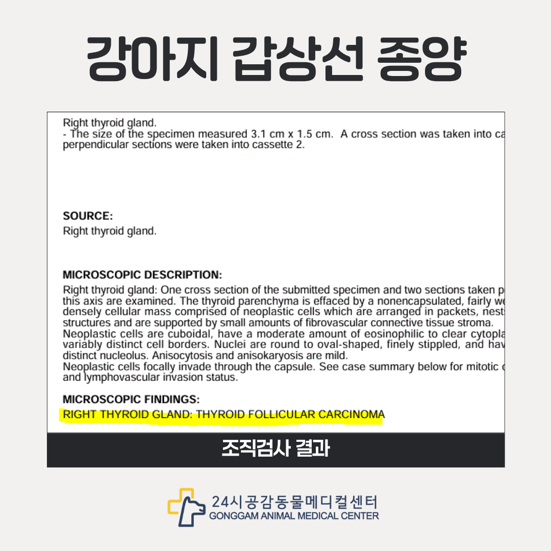 FNA조직검사 결과