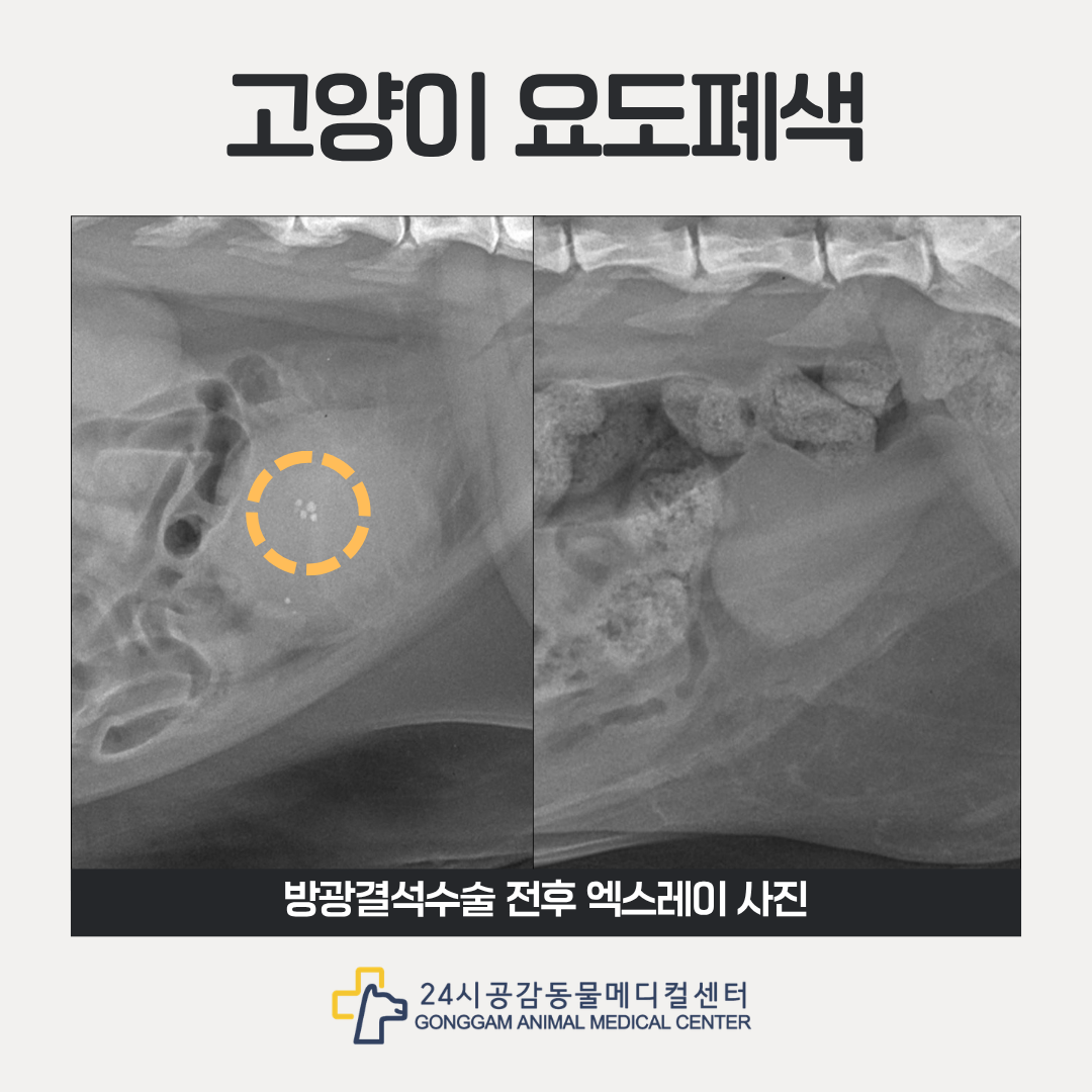 방광결석 수술 전후 엑스레이사진 공감 방광결석 수술 전후 엑스레이사진